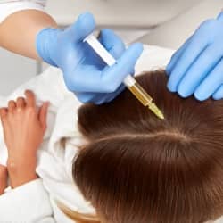 Tratamiento de alopecia femenina