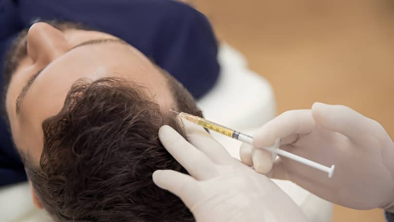 Tratamiento de la alopecia masculina